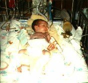1993 - at 1 day old